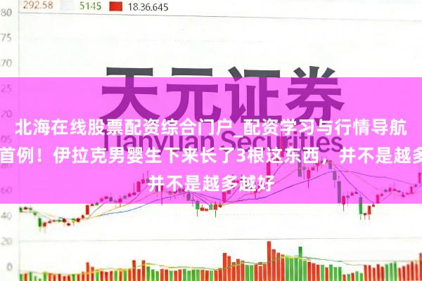 北海在线股票配资综合门户_配资学习与行情导航 环球首例!伊拉克男婴生下来长了3根这东西,并不是越多越好